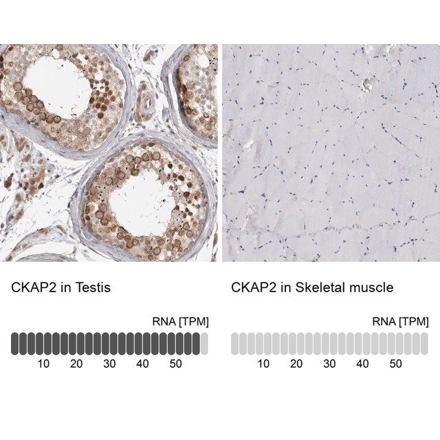 Anti-CKAP2 antibody produced in rabbit