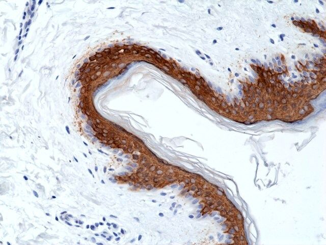 Anti-CK10 (Cytokeratin-10) Rabbit Monoclonal Antibody