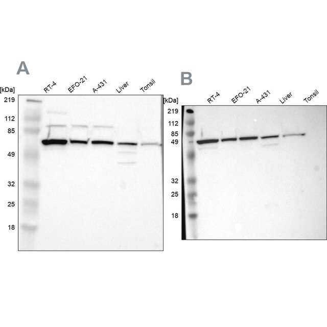 Anti-CKAP4 antibody produced in rabbit