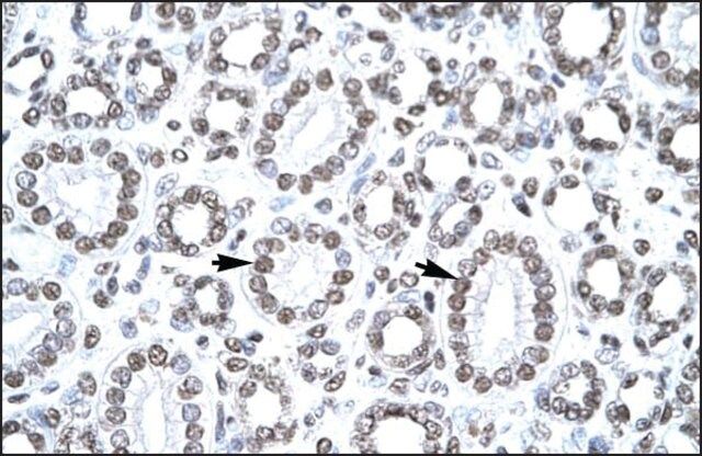 Anti-CITED1 antibody produced in rabbit