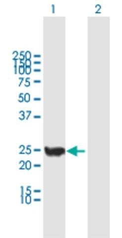 Anti-CINP antibody produced in mouse