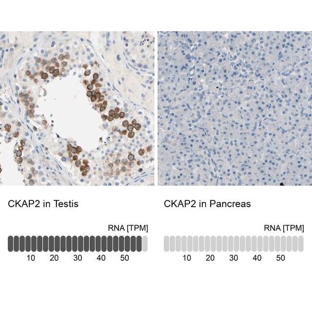 Anti-CKAP2 antibody produced in rabbit