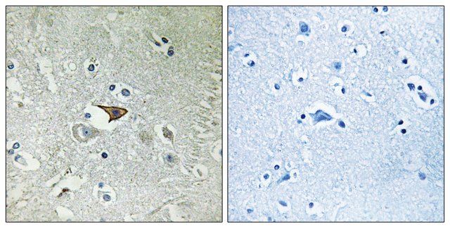 Anti-CCR5 antibody produced in rabbit