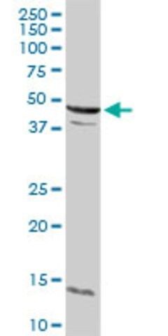 Anti-CCNE2 antibody produced in rabbit