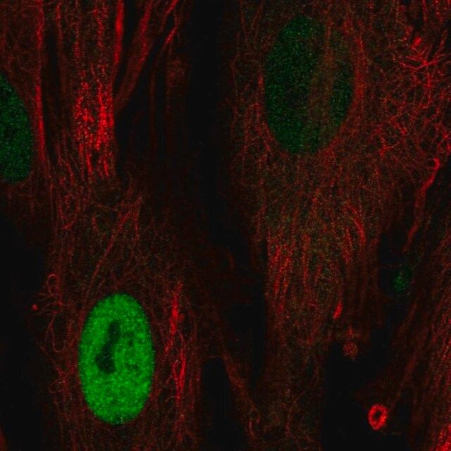 Anti-CCND1 antibody produced in rabbit