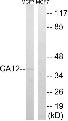 Anti-CA12 antibody produced in rabbit