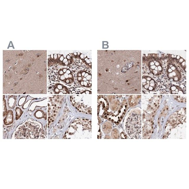 Anti-BUD13 antibody produced in rabbit