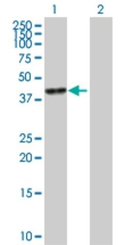 Anti-CA6 antibody produced in mouse