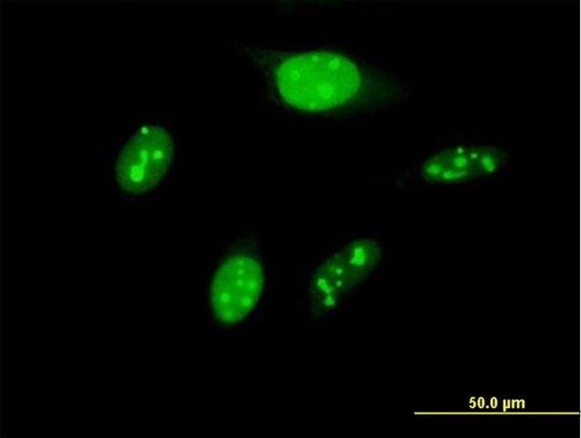 Anti-BYSL antibody produced in mouse