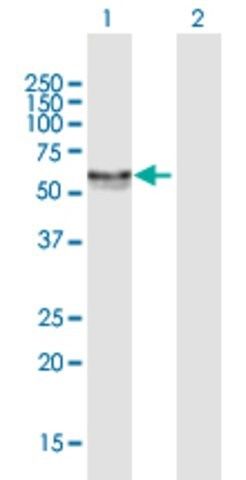 Anti-CA9 antibody produced in mouse