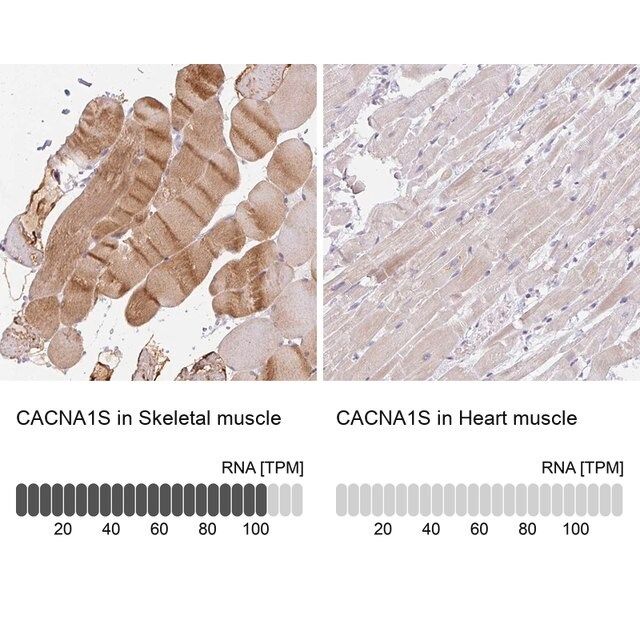 Anti-CACNA1S antibody produced in rabbit