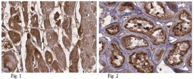 Anti-BAG family molecular chaperone regulator 3 (BAG3) Antibody