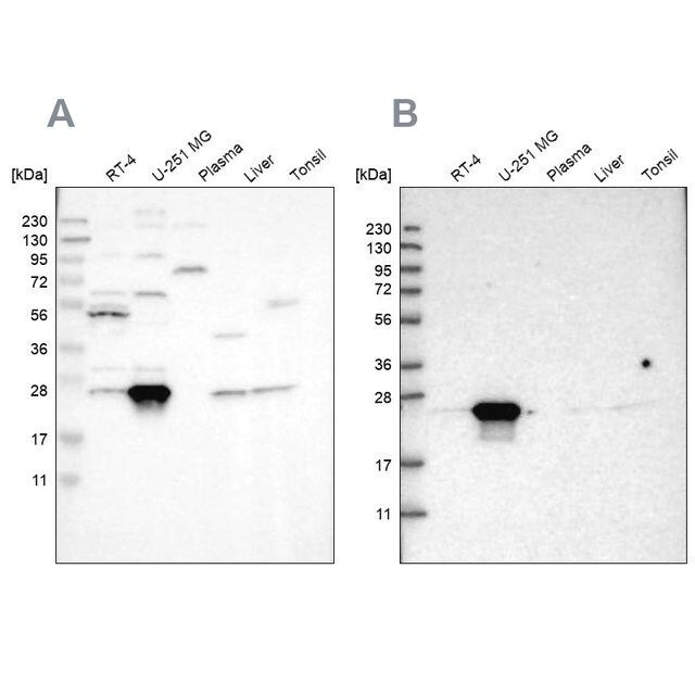 Anti-BAG2 antibody produced in rabbit