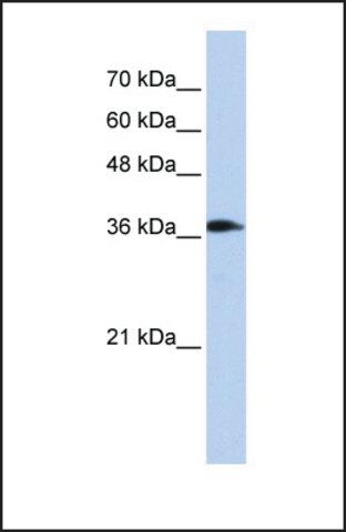 Anti-ATP6V0D2 antibody produced in rabbit