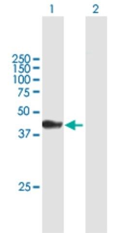 Anti-ATPGD1 antibody produced in mouse