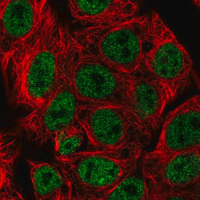 Anti-ARRB1 antibody produced in rabbit