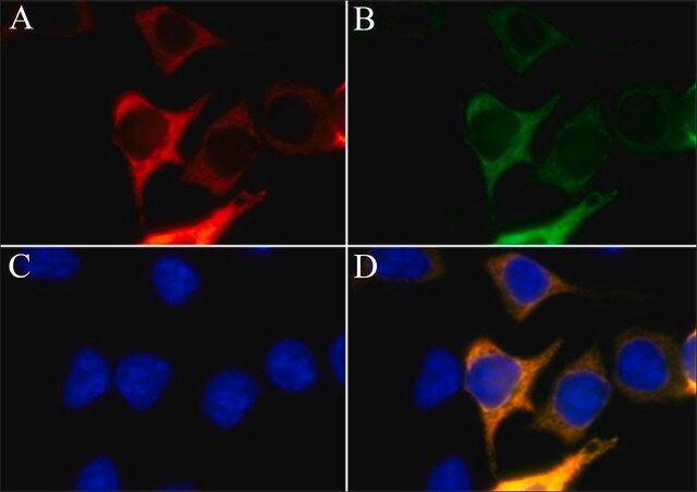 Anti-AsCas12a (Cpf1) antibody, Mouse monoclonal