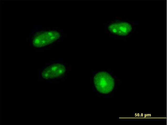 Anti-APTX antibody produced in mouse