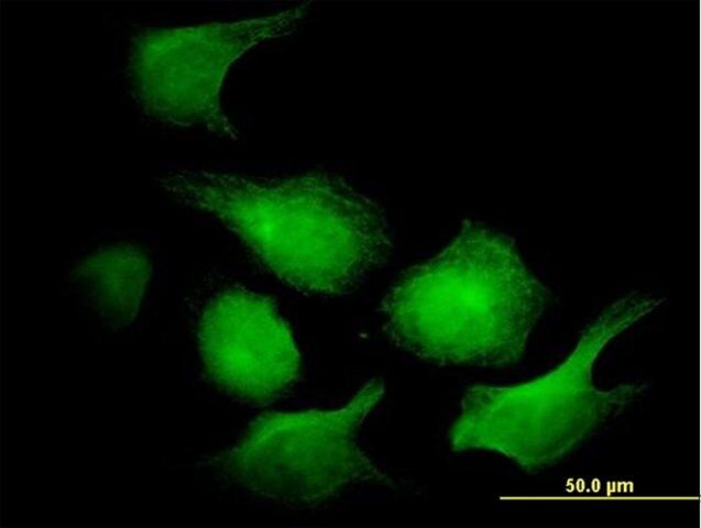 ANTI-AK1 antibody produced in mouse