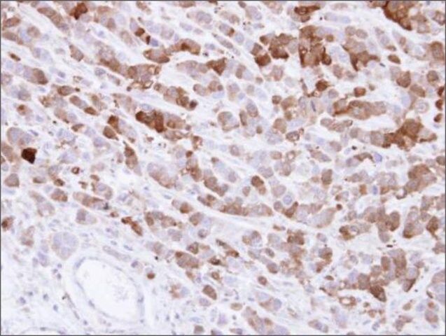 Anti-AKR1C1 antibody produced in rabbit