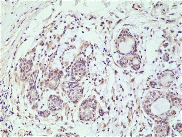 Anti-AKT (PH domain) antibody, Rabbit monoclonal