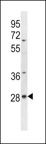 ANTI-ALKBH4 (CENTER) antibody produced in rabbit