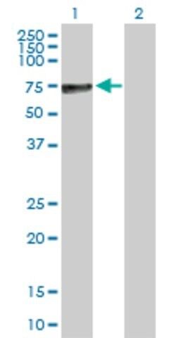 Anti-ALPP antibody produced in rabbit