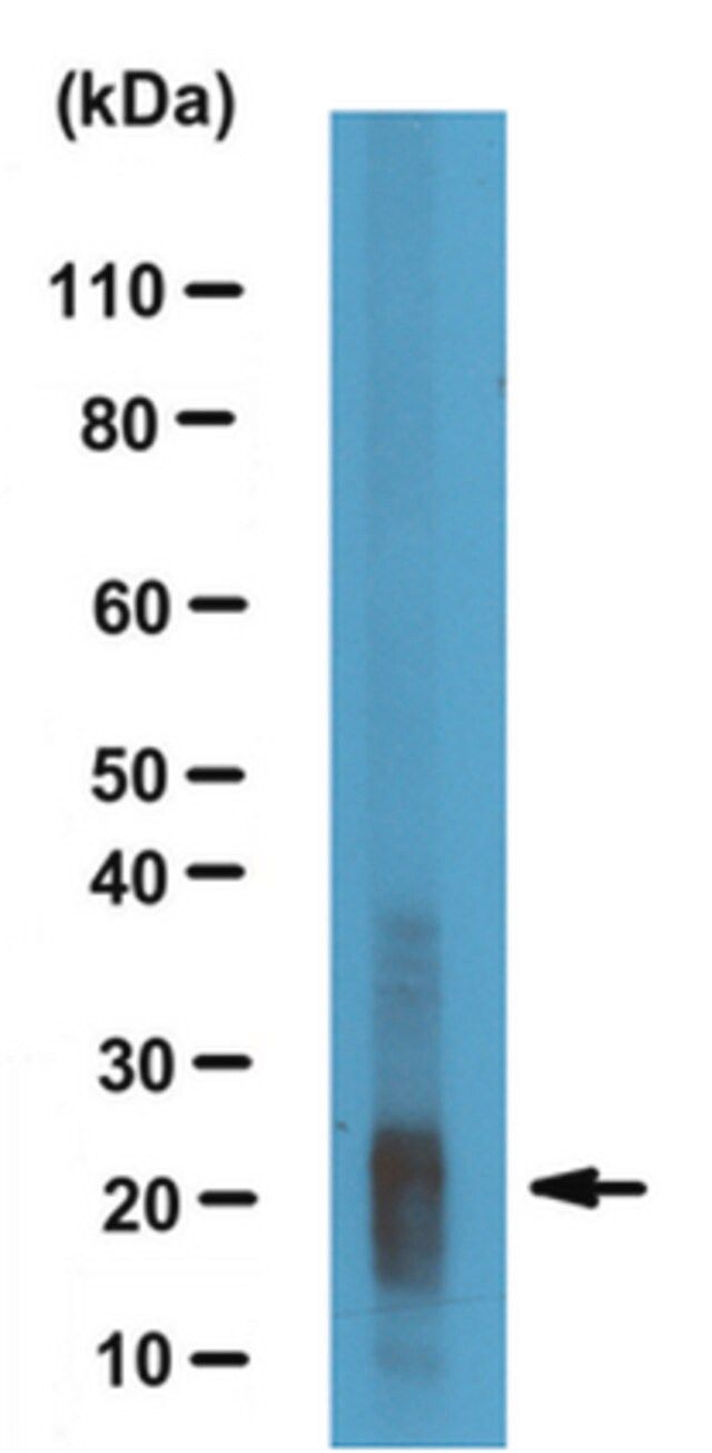 Anti-Amelogenin, X isoform/AMELX Antibody