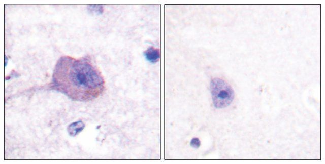 Anti-AMPK 1 antibody produced in rabbit