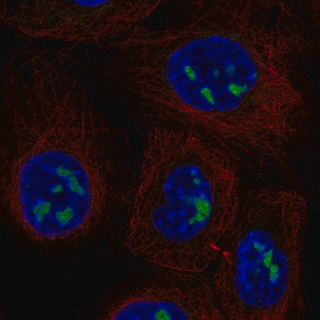 Anti-ADAMTS12 antibody produced in rabbit