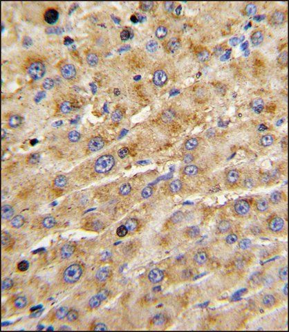 ANTI-ADAMTS13 (CENTER) antibody produced in rabbit