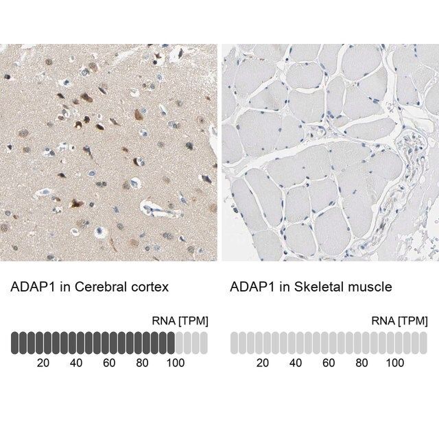 Anti-ADAP1 antibody produced in rabbit