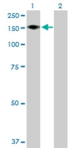 Anti-ADAMTS18 antibody produced in mouse