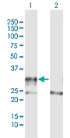 Anti-ADAMTS4 antibody produced in rabbit