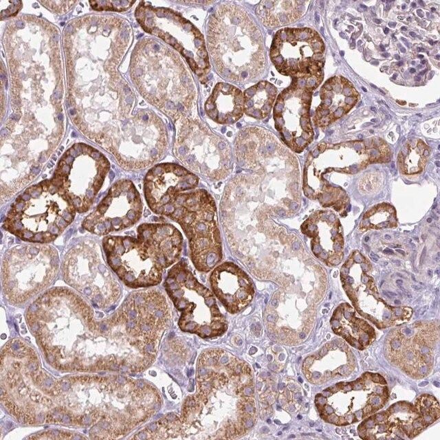 Anti-ADAMTS19 antibody produced in rabbit