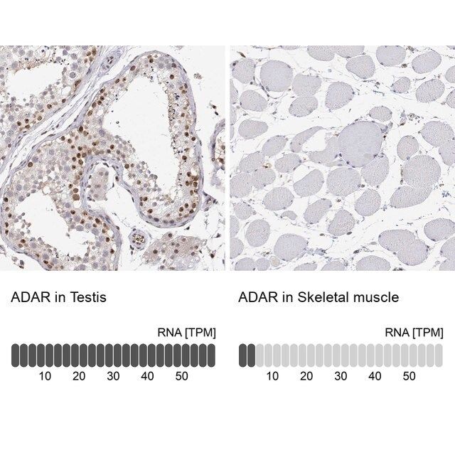 Anti-ADAR antibody produced in rabbit