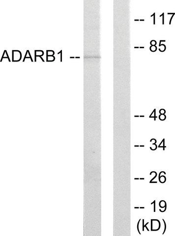 Anti-ADARB1 antibody produced in rabbit