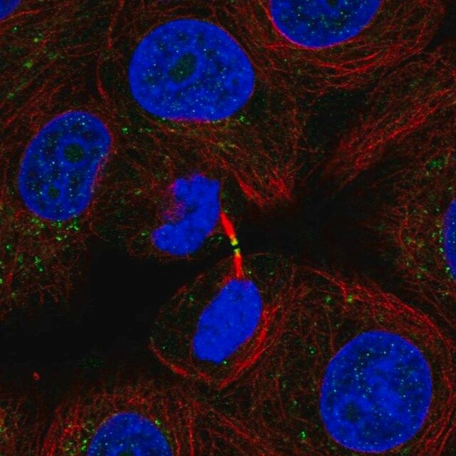 Anti-ADAMTS19 antibody produced in rabbit