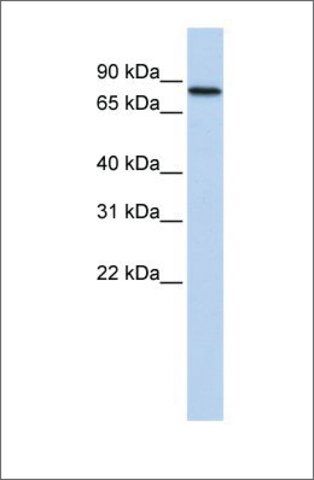 Anti-ADARB2 antibody produced in rabbit