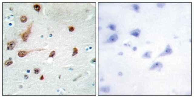 Anti-ADAR1 antibody produced in rabbit