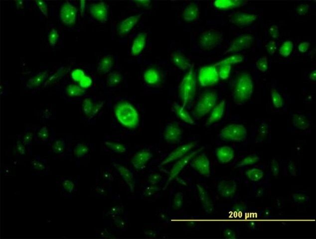 Anti-ADAP1 antibody produced in mouse