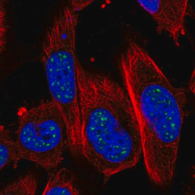 Anti-ADAMTS4 antibody produced in rabbit