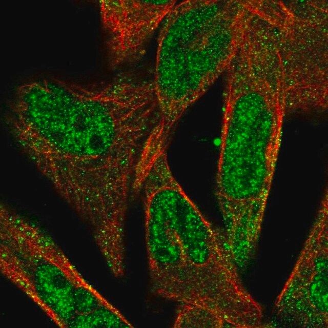 Anti-ADAMTS5 antibody produced in rabbit