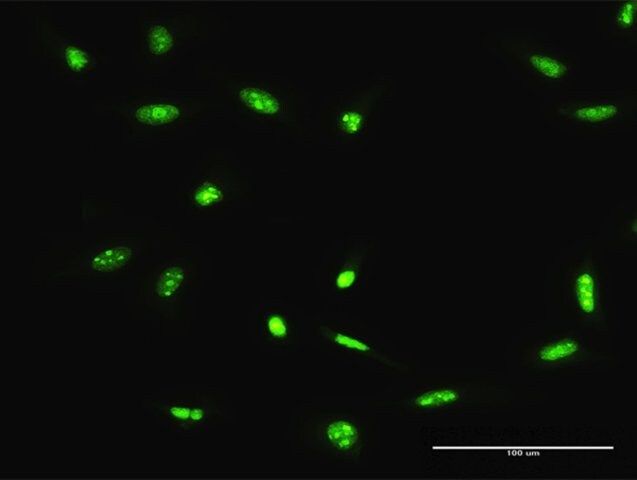 Anti-ADAR antibody produced in rabbit