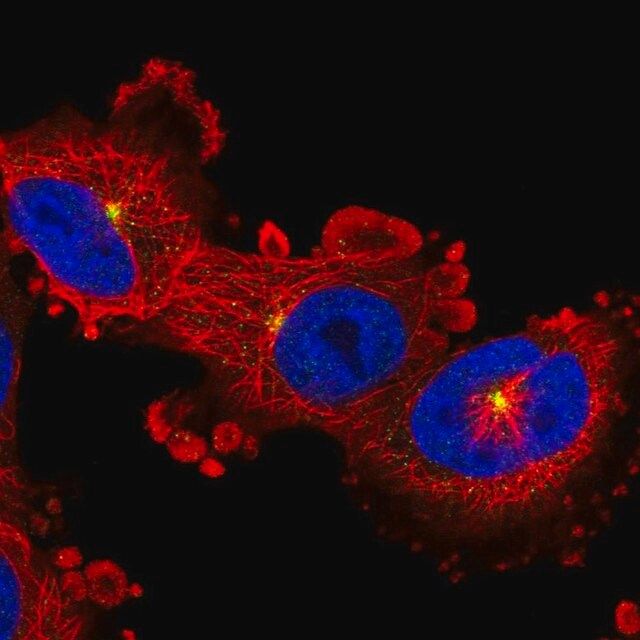 Anti-ADGRB2 antibody produced in rabbit