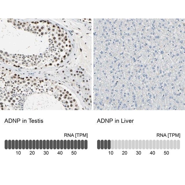 Anti-ADNP antibody produced in rabbit