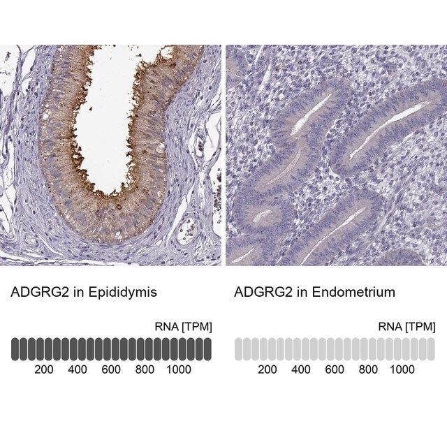 Anti-ADGRG2 antibody produced in rabbit