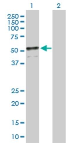 Anti-ADFP antibody produced in mouse