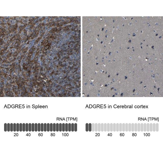 Anti-ADGRE5 antibody produced in rabbit