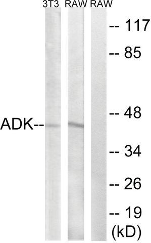 Anti-ADK antibody produced in rabbit